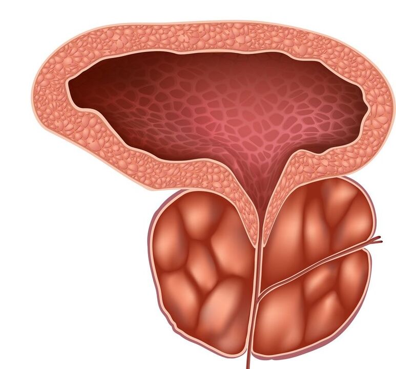 Próstata inflamada que a Prostalina pode manexar