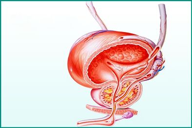 A inflamación da próstata na prostatite aguda é unha limitación para o sexo